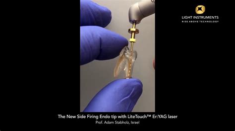 The New Side Firing Endo Tip With Litetouch™ Eryag Laser Youtube