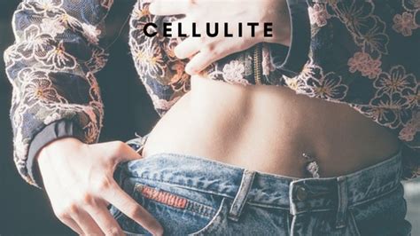 Cellulite Cause E Rimedi Naturali Articolo Gaia Bassi