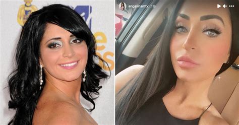 Has Jersey Shore Alum Angelina Pivarnick Gone Under The Knife Doctors Weigh In On Different