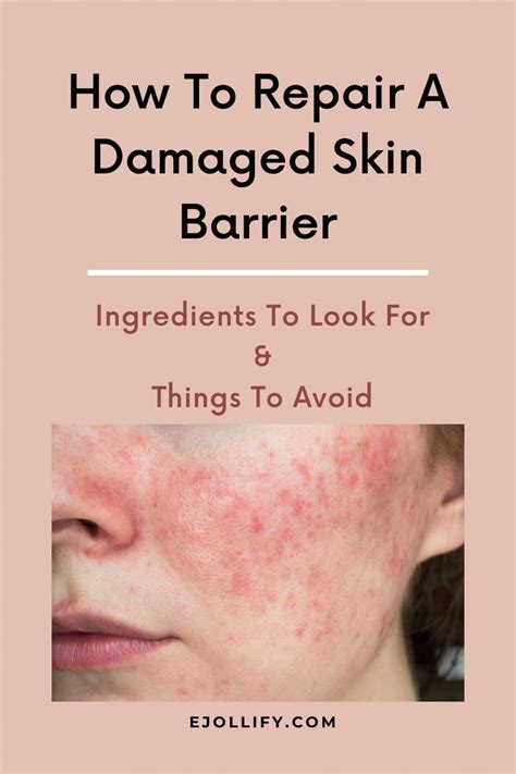 9 Tips On How To Repair Damaged Skin Barrier Damaged Skin Repair