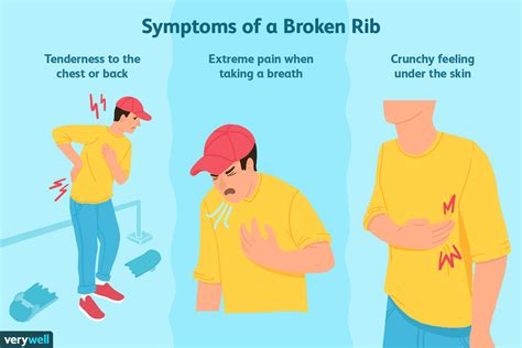 Cracked Rib Symptoms Diagnosis Treatment And More