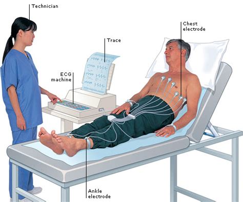 Electrocardiogram Ecg Working Principle Normal Ecg Wave