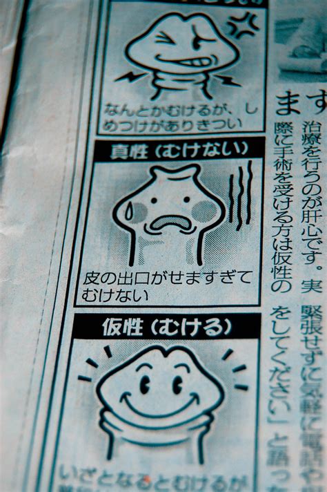 Japanese Foreskin Ad 200811i Flickr