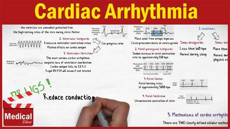 Pharmacology Cardiac Arrhythmia And Antiarrhythmic Drugs From A To Z