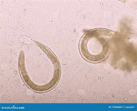 Strongyloides Stercoralis Or Threadworm In Human Stool Stock Image