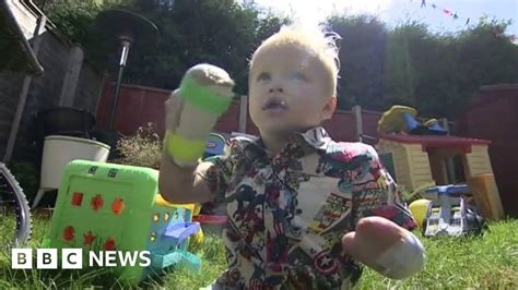 Two Year Old Amputee Strongest Baby In The World Bbc News