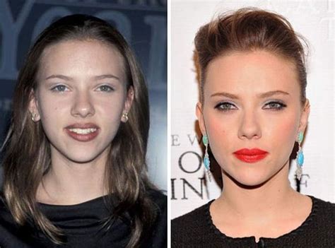 Scarlett Johansson Plastic Surgery Breast Reduction