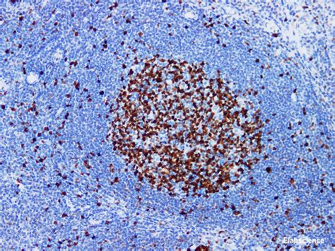 High Affinity And Specificity Ki 67 Monoclonal Antibody Pa6189 At
