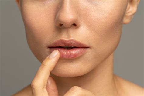 How To Reduce Bruising After Lip Fillers Envision Aesthetics