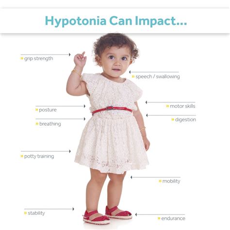 Hypotonia 101 A Comprehensive Guide For Parents Surestep Low