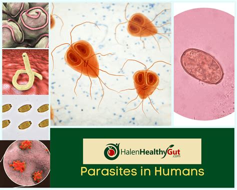 Parasite Cleanse Diet For Humans 21 Best Natural Remedies