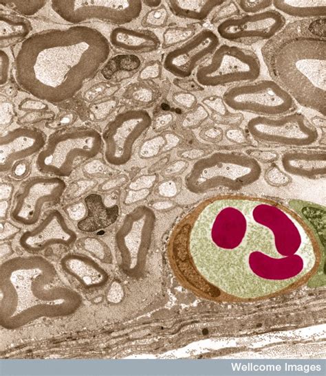 Myelin Facilitation Of Whole Brain Neuroplasticity
