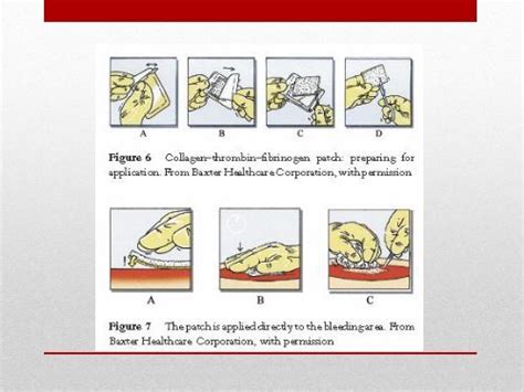 Regional Postpartum Hemorrhage Guidelines