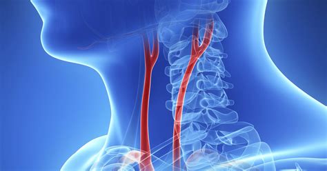 Cooper Connection Blocked Carotid Arteries Lead To Stroke