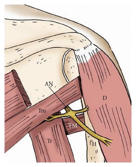 The Drawing Shows The Axillary Nerve Within The Quadrilateral Space