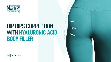 Hip Dips Correction With Hyaluronic Acid Body Fillers Youtube