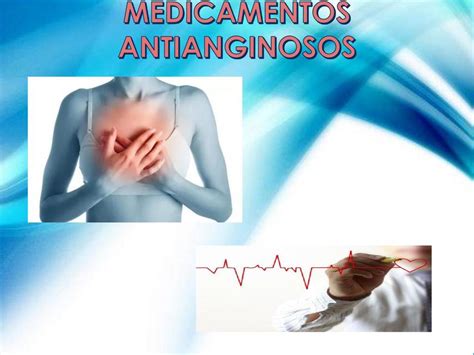 Angina De Pecho Juan Carlos Rios Martinez Udocz