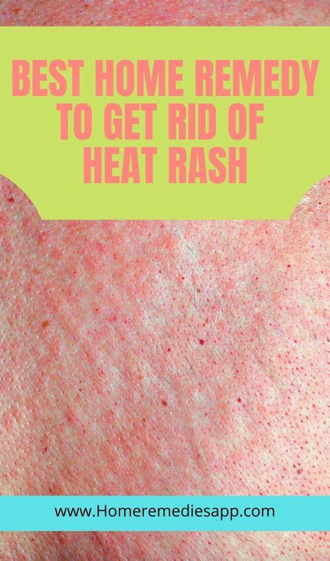 14 Best Heat Rash On Dogs Ideas Dogs Heat Rash Dog Care