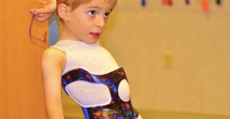 Dynamic Braces For Kids With Scoliosis Now In Development