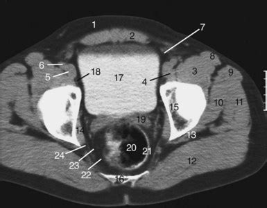 The pelvis | Radiology Key