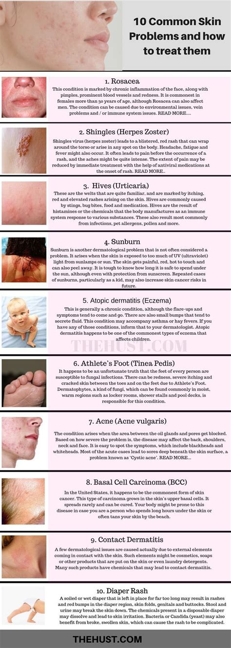 Common Skin Conditions And Problems Pictures And Treatments Skin