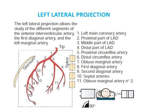 Diagonal earlobe creases and prognosis in patients with suspected coronary artery disease. Identification of coronary arteries by different ...