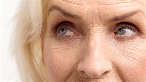 Wrinkles Be Gone Thomson Specialist Skin Centre