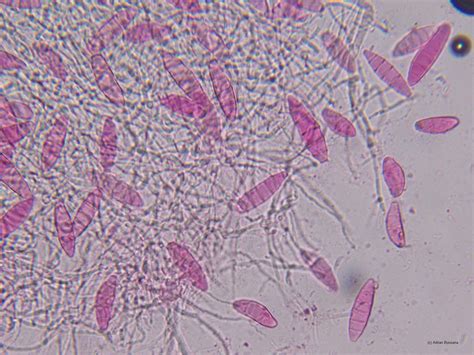 Regnum Prokaryotae Fungi Images