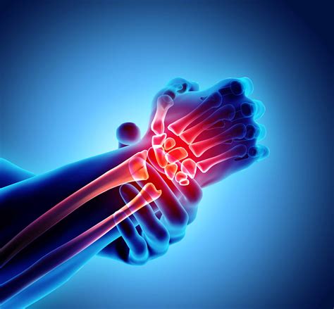 Hand And Wrist Pain Causes And Treatment Northeast Spine And Sports