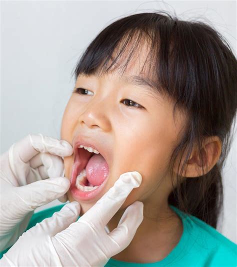 Causes Of Epiglottitis In Children Symptoms And Treatment