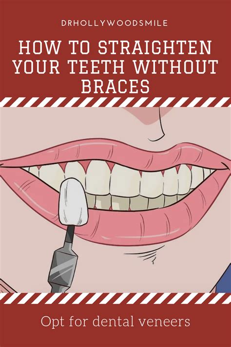 But it depends on how crooked they are. How to Straighten Your Teeth Without Braces | Dental ...