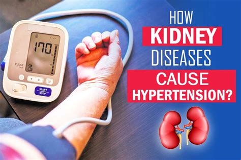 Does Kidney Disease Cause Hypertension