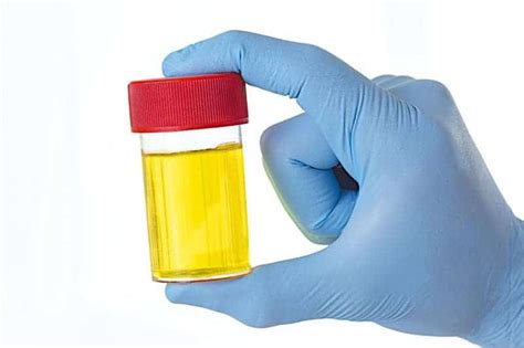 Medical Breakthrough Chemical Composition Of Human Urine Determined