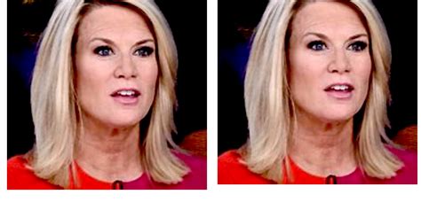 What Happened To Martha Maccallum On Fox News