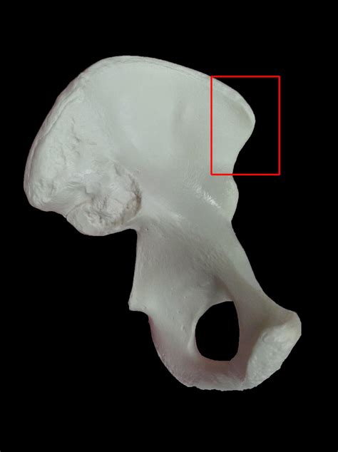 Anterior superior iliac spine (asis) avulsion. Osteology: Pelvic Girdle & Lower Extremities - Anatomy Zoo ...