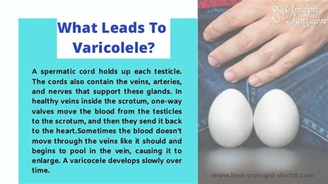 How Varicocele Can Affect Male Fertility