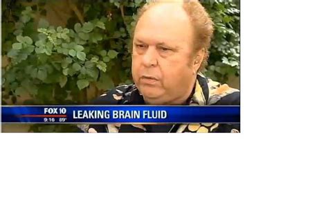 Nose Leaking Brain Fluid Joe Nagy Suffers From Runny Nose For A Year Only To Discover Fluid Was