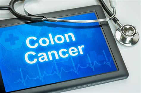 At What Age Should I Get Screened For Colon Cancer