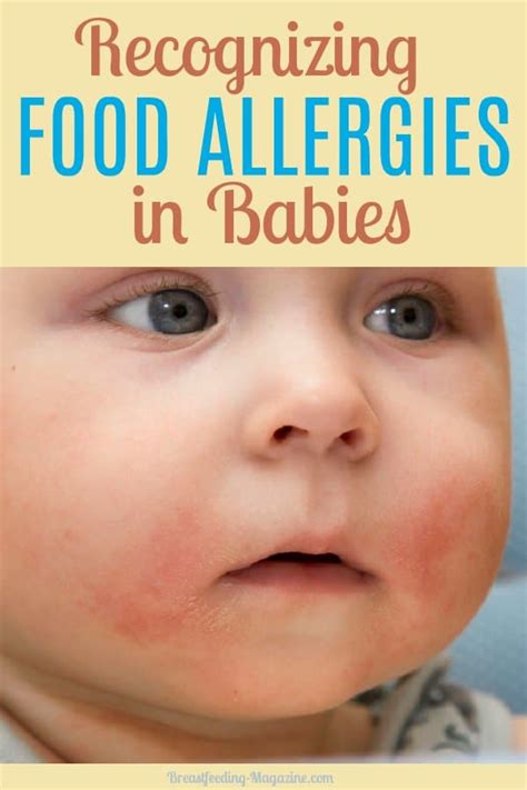 More than 160 foods have been found to cause allergic reactions. Food Allergies in Babies Who Breastfeed - Common Signs and ...