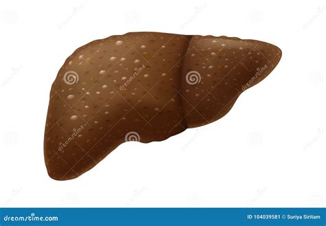 Human Liver Have Scar Tissue Problem From Heavy Drink Stock Vector