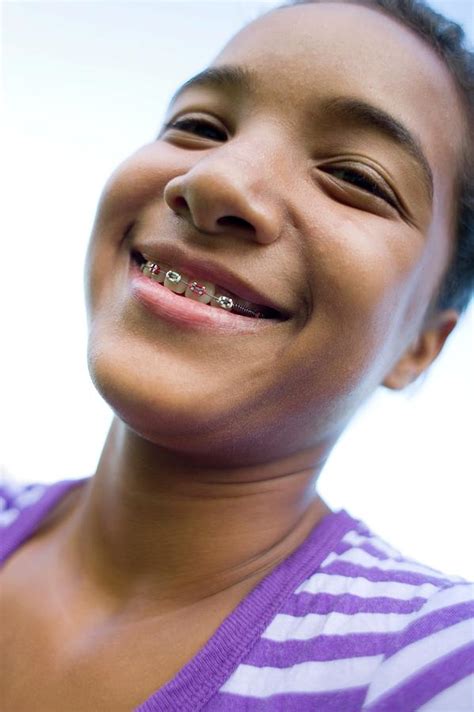 Girl Wearing Dental Braces Photograph By Ian Hooton Science Photo