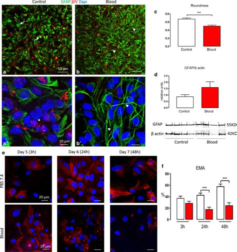 Preterm Intraventricular Hemorrhage In Vitro Modeling The