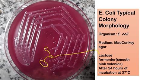 E Coli Typical Colony Morphology On Macconkey Agar Youtube