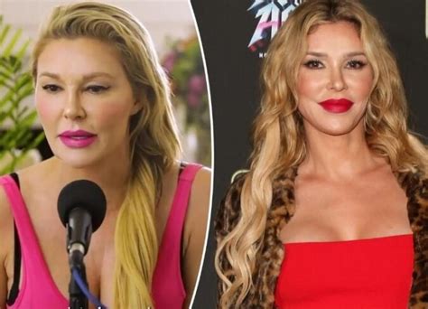 Brandi Glanvilles Bad Plastic Surgery 2023 View Before And After