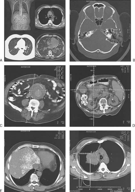 Computed Tomography Radiology Key