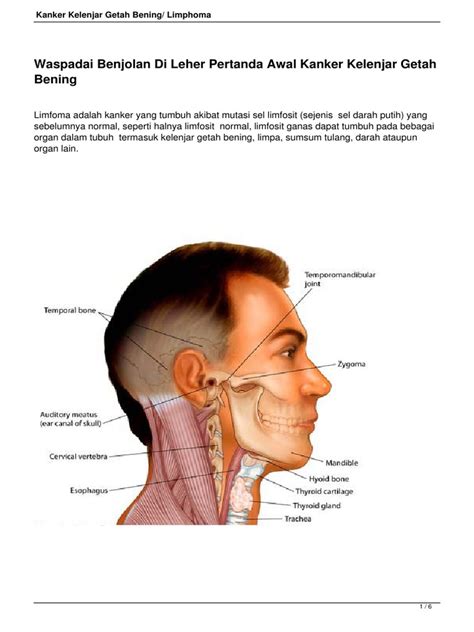 Kanker kelenjar getah bening umumnya ditemukan di bagian ketiak, leher, juga di selangkangan dan paha. kanker-getah-bening.pdf