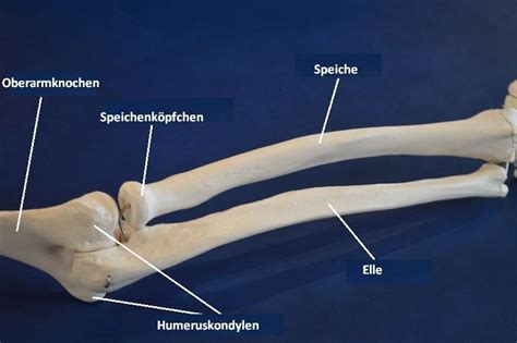 Sie tritt meist bei kindern zwischen 1 und 4 jahren auf, bei kindern über 5 jahren existiert sie praktisch nicht mehr. Proximale Radiusfraktur, Physiotherapie, Kind, distal ...