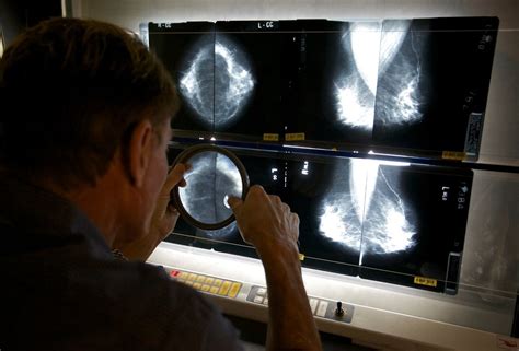 Mammograms Value In Cancer Fight At Issue The New York Times