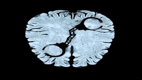 The Anatomy Of A Violent Brain