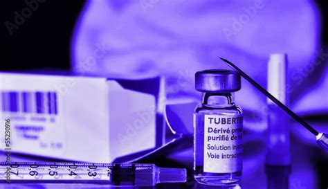 Vaccination Contre La Tuberculosetestcutie Photo Stock Adobe Stock